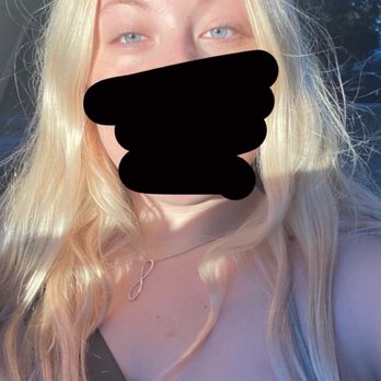 Skin Serenity Spa - Before i got them tinted!! - Skin Care Near Me - Stuart, Florida