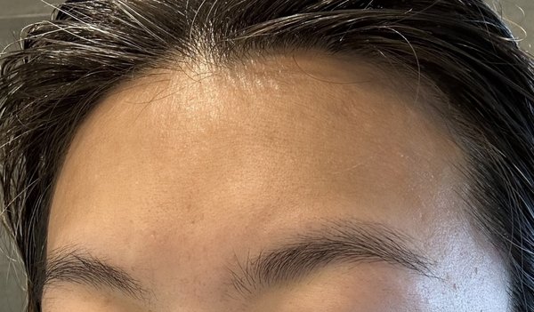 Acne Institute by null