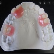 denture 様　NEIGHBORHOOD Expert Dentures Kent, WA - Toulus Dentures & Implants Center