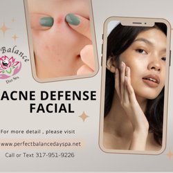 Perfect Balance Day Spa - The Acne Defense Facial is a specialized treatment that focuses on minimizing and fighting acne breakouts.