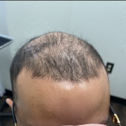 Restored Roots - Before