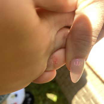 L&T Nails & Spa - The bottom of my toe that he scrubbed the skin off. - Nail Salons Near Me - Newark, Delaware L&T Nails & Spa - The bottom of my toe that he scrubbed the skin off. - Nail Salons Near Me - Newark, Delaware