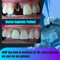 Affordable Dental Health Providers - Patient had a dental implant procedure done by ADHP.