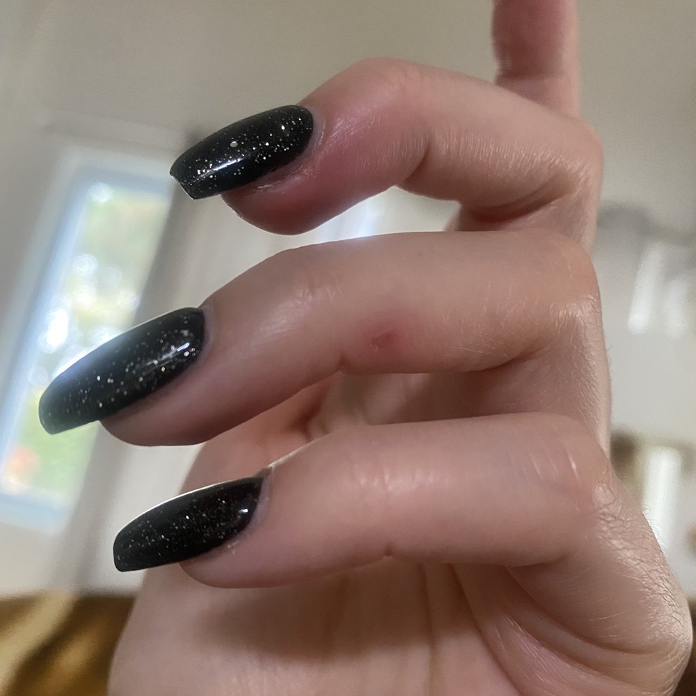 Here's how red and swollen my fingers got Here's how red and swollen my fingers got