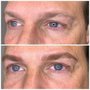 Photo of Posh Brows