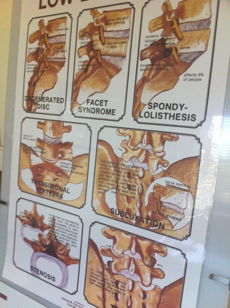 KAUAI CHIROPRACTIC AND WELLNESS CENTER Updated September 2024 12 Reviews 3092 Akahi St