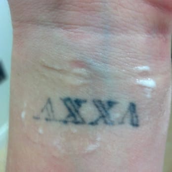 LaserAway - My tattoo prior to treatment. The gooey stuff is the numbing ointment. - Laser Hair Removal Near Me - Lake Forest, California