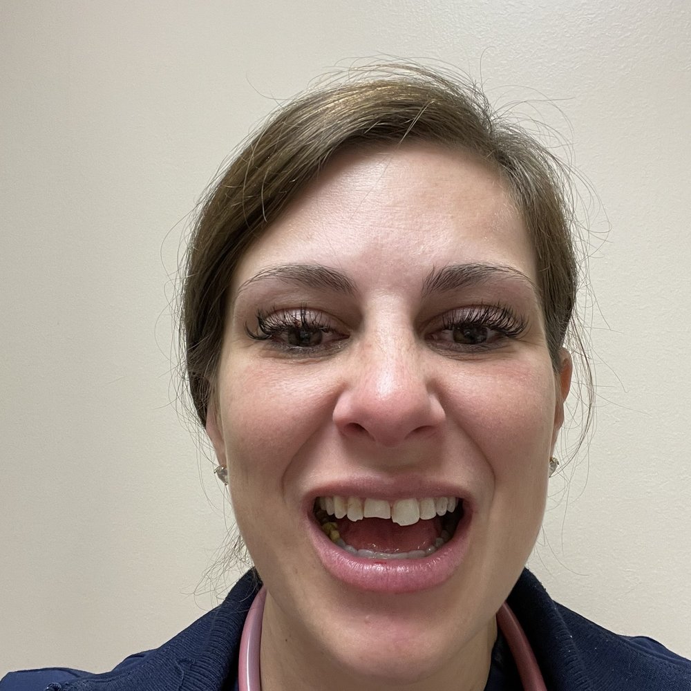 Broken teeth before