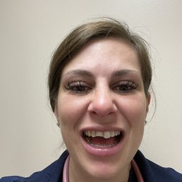 Broken teeth before Broken teeth before