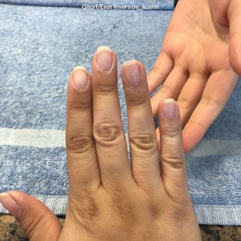 Organic Spa and Nails - My nails after they took off three week old sns - Nail Salons Near Me - Austin, Texas Organic Spa and Nails - My nails after they took off three week old sns - Nail Salons Near Me - Austin, Texas