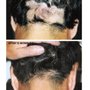 Photo of Australian Hair & Scalp Clinic