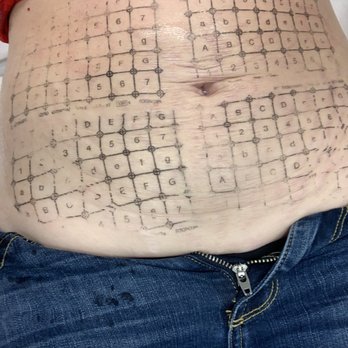 LaserAway - Laser Hair Removal Near Me - Las Vegas, Nevada LaserAway - Laser Hair Removal Near Me - Las Vegas, Nevada