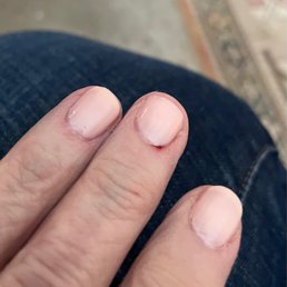 Damage from cuticles cut roughly. Damage from cuticles cut roughly.