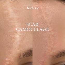 Ksthetic - Scar Camouflage