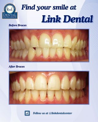 Link Dental Excellence by null