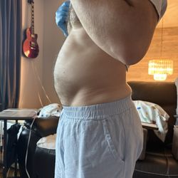 Akron Digestive Health - Distended belly