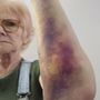 Proliance Bone & Joint Urgent Care