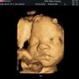Photo of Hello Baby Imaging