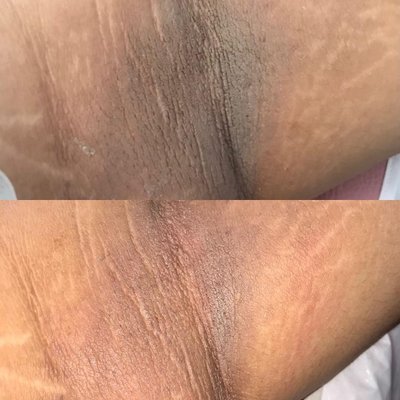 Intimate Bleaching - INTIMATE BLEACHING
One of our most popular services!
Currently, we are the only salon/spa offering intimate bleaching in the greater Portland metro area!  This process is safe and effective for lightening even the most sensitive areas. This service is intended for the groin and backside area but can also be done on the inner thighs, under arms and nipples.
