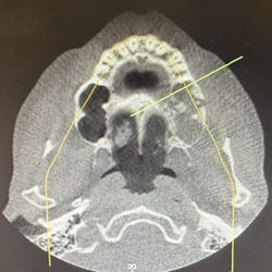 Guyette Facial & Oral Surgery Center - Left sinus area scan.