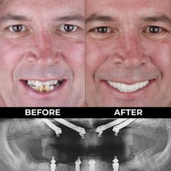 Dental Clinic Tijuana