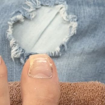 Coco Nail Spa - Here is my toe nail damaged - Nail Salons Near Me - Houston, Texas Coco Nail Spa - Here is my toe nail damaged - Nail Salons Near Me - Houston, Texas