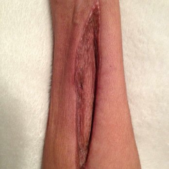 Calvon Voong, MD - After 3 surgeries several pain Dr's before I was referred to Dr Voong Never closed but Voong found meds to give me my life back ;) - Pain Management Near Me - Visalia, California