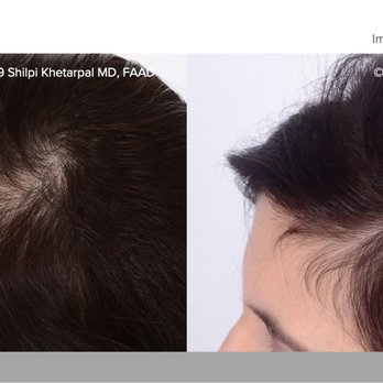 Metroderm DC - PRP Washington, DC 20006 - Dermatologists Near Me - Washington, DC, District of Columbia
