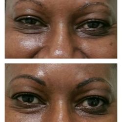 That New Look Skincare Specialist & Permanent Makeup Artist - Before and after permanent makeup eyebrows