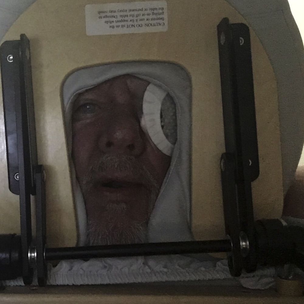 Meadows Eye Physicians & Surgeons - My downwards face positioning for a week or two following my detached retinal surgery by Meadows Eye, Dr Calvo! Thanks again Doctor - Ophthalmologists Near Me - Henderson, Nevada Meadows Eye Physicians & Surgeons - My downwards face positioning for a week or two following my detached retinal surgery by Meadows Eye, Dr Calvo! Thanks again Doctor - Ophthalmologists Near Me - Henderson, Nevada