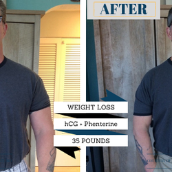 Mission Med Spa - The Botox Bar & Wellness Medical Weight Loss
