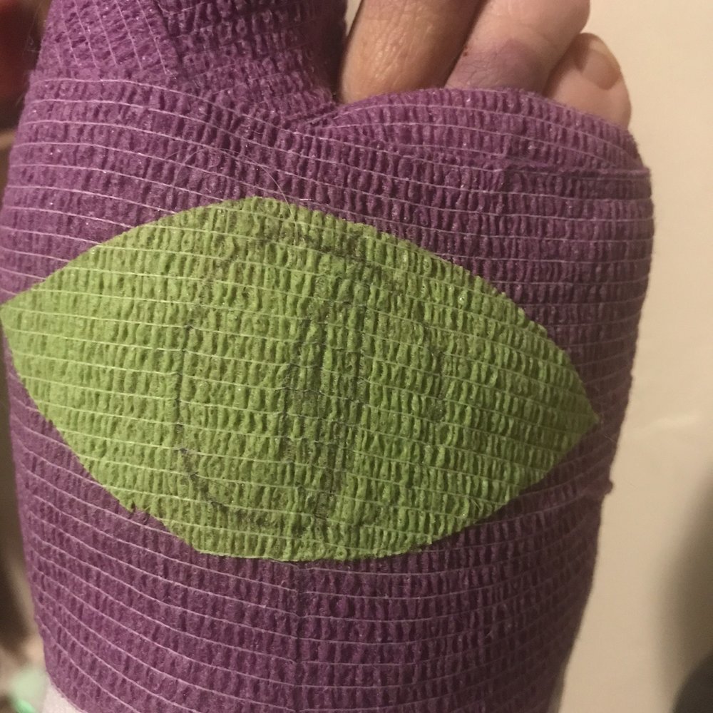 Joseph Knedgen, DPM FACFAS DABFAS - Eye of Sauron Foot Wrap - Coolest Thing Ever! - Podiatrists Near Me - Reno, Nevada