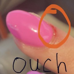 A&D said this is a normal part of getting your nails done. A&D said this is a normal part of getting your nails done.