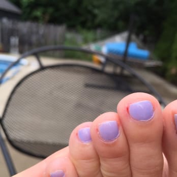 Safety First Nail Spa - Two days later and my feet are still bleeding and irritated - Nail Salons Near Me - Buffalo, New York Safety First Nail Spa - Two days later and my feet are still bleeding and irritated - Nail Salons Near Me - Buffalo, New York