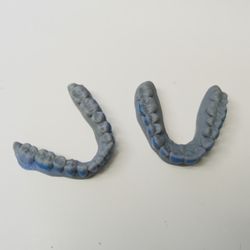 Ben Yount, DDS - Models printed out form 3D scanning.