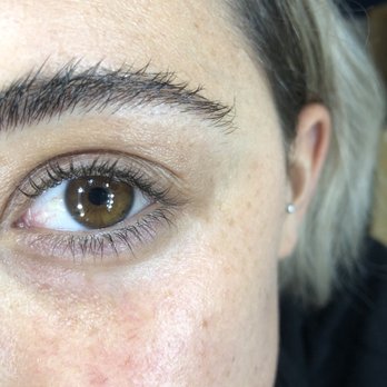 Beautycode - Before - Skin Care Near Me - Morgan Hill, California Beautycode - Before - Skin Care Near Me - Morgan Hill, California