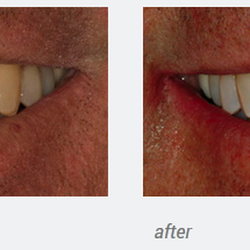 Richard B Waghalter DDS - Healthy Smiles