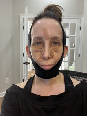 Austin-Weston, The Center For Cosmetic Surgery by null