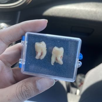 Alum Rock Dental - Wisdom Teeth - Oral Surgeons Near Me - San Jose, California Alum Rock Dental - Wisdom Teeth - Oral Surgeons Near Me - San Jose, California