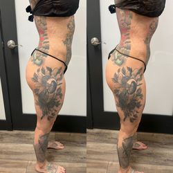 Nova Face and Body