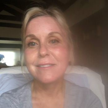Edward H Park, MD - One week after Laser resurfacing and lower face and neck lift. - Cosmetic Surgeons Near Me - Upland, California