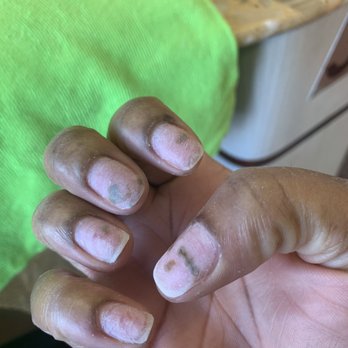 Just For Nails - nail damage and fungus - Nail Salons Near Me - Stockbridge, Georgia Just For Nails - nail damage and fungus - Nail Salons Near Me - Stockbridge, Georgia