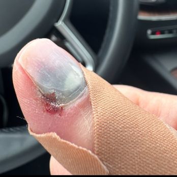 Lee Nails - Before - Nail Salons Near Me - Kenosha, Wisconsin