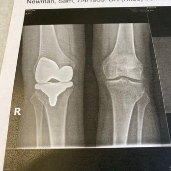 Rancho Physical Therapy - You can't see my in this pic ... - Physical Therapy Near Me - San Marcos, California Rancho Physical Therapy - You can't see my in this pic ... - Physical Therapy Near Me - San Marcos, California