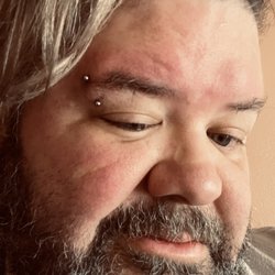 MINT Piercing Studio - My face. Just a little swelling. Perfectly normal.