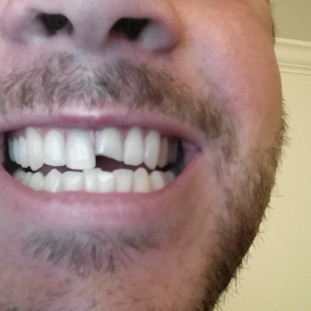 Andrew B Fong, DDS - General Dentistry Near Me - San Jose, California Andrew B Fong, DDS - General Dentistry Near Me - San Jose, California