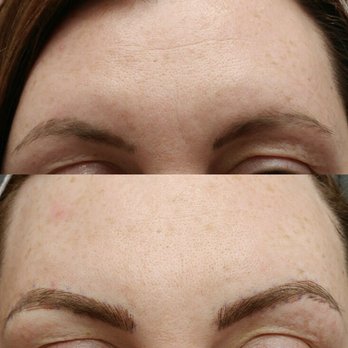 The Brow Nurse - Tattoo Removal Near Me - Redlands, California The Brow Nurse - Tattoo Removal Near Me - Redlands, California
