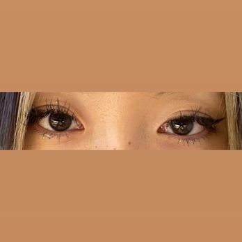 Dr. Kenneth Kim Plastic Surgery - my left eyelid had a different fold than my right eyelid - Plastic Surgeons Near Me - Los Angeles, California Dr. Kenneth Kim Plastic Surgery - my left eyelid had a different fold than my right eyelid - Plastic Surgeons Near Me - Los Angeles, California