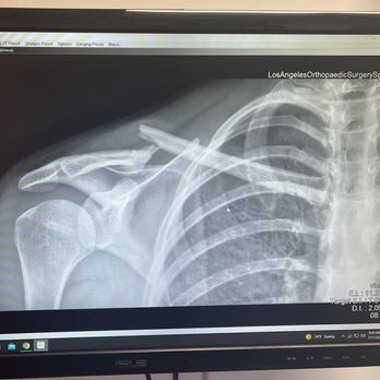 Arman Ossia, MD - Dr Ossia told me to put a bandage on this LOL - Family Practice Near Me Arman Ossia, MD - Dr Ossia told me to put a bandage on this LOL - Family Practice Near Me