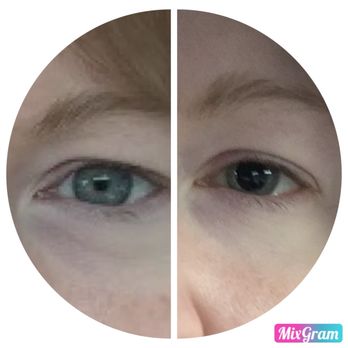 Gateway Eye Clinic - Before and after. - Optometrists Near Me - Portland, Oregon Gateway Eye Clinic - Before and after. - Optometrists Near Me - Portland, Oregon